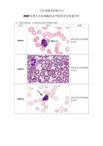 2009年第1次血细胞形态学检查室间质量评价