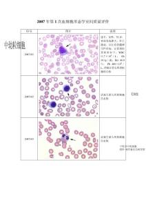2007年第1次血细胞形态学室间质量评价