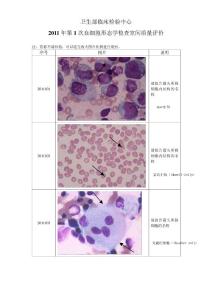 2011年第1次血细胞形态学检查室间质量评价图片（及答案）