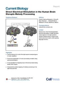 Current-Biology_2017_Direct-Electrical-Stimulation-in-the-Human-Brain-Disrupts-Melody-Processing