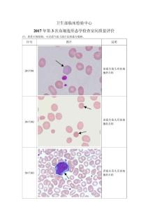 2017年第3次血细胞形态学检查室间质量评价