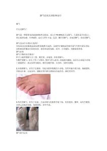 脚气症状及预防和治疗