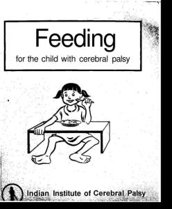 Feeding for the child with cerebral palsy