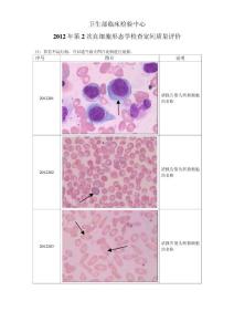2012年第2次血细胞形态学检查室间质量评价