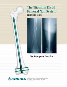 Titanium Distal Femoral Nail System Technique Guide