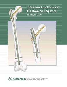 Titanium Trochanteric Fixation Nail System Technique Guide