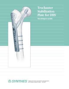 Trochanter Stabilization Plate for DHS_ Technique Guide