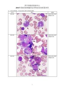 2014年第1次血细胞形态学检查室间质量评价图片