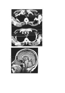 江苏大学09级影像断局解考试图