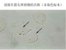 尿沉渣形态学检查室间质量评价图片