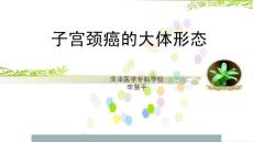 子宮頸浸潤(rùn)癌