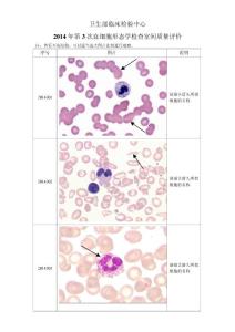 2014年第3次血细胞形态学检查室间质量评价