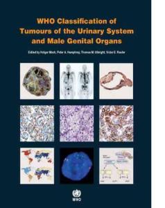 WHO Classification of Tumours of Urinary System and Male Genital Organs//2016