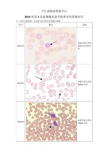 2016年第1次血细胞形态学检查室间质量评价