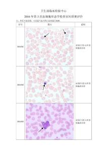 2016年第3次血细胞形态学检查室间质量评价