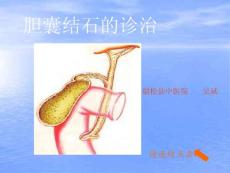 胆结石 ppt课件