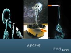 喉癌 ppt课件