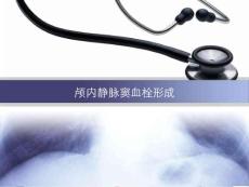 颅内静脉窦血栓形成ppt参考课件