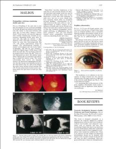 Pupillary abnormality（瞳孔异常）
