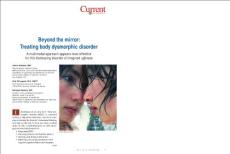 Beyond the mirror treating body dysmorphic disorder（超越镜子治疗身体畸形）