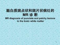 脑白质斑点状和斑片状病灶的mr 诊 断ppt演示幻灯片