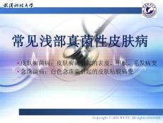 皮肤病学之常见真菌性皮肤病ppt课件