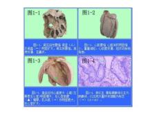 病理图片