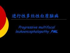 进行性多灶性白质脑病Progressive multifocal leukoencephalopathy ,PML