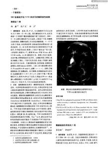 MRI呈基底節(jié)區(qū)T1WI高信號(hào)的糖尿病性偏側(cè)舞蹈癥1例