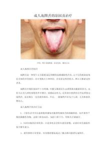 成人地图舌的原因及治疗