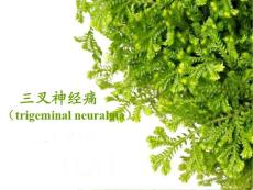 三叉神经痛