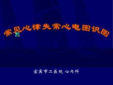 常见心律失常