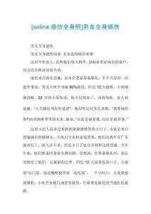 [selina烧伤全身照]男友全身烧伤