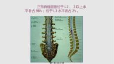 脊髓拴系综合征手术治疗