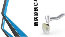 龋齿的治疗