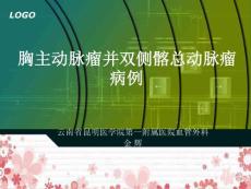 胸主动脉瘤并双侧髂总动脉瘤病例