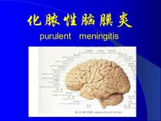 化脓性脑膜炎