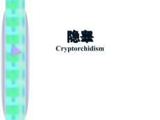 隐睾的护理