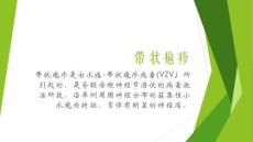 带状疱疹