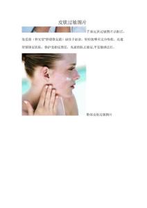 皮肤过敏图片