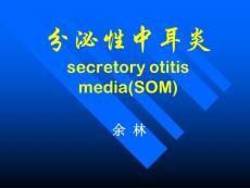 分泌性中耳炎 急性化脓性中耳炎ppt课件