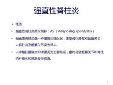强直性脊柱炎
