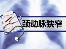 颈动脉狭窄PPT课件