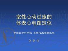 室性心动过速体表心电图定位
