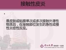 接触性皮炎和湿疹
