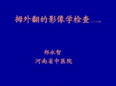 指拇外翻诊断