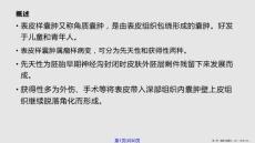 表皮样囊肿的超声幻灯学习课程