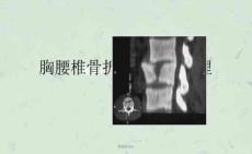 胸腰椎骨折课件