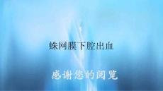 蛛网膜下腔出血2