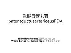 动脉导管未闭patentductusarteriosusPDA